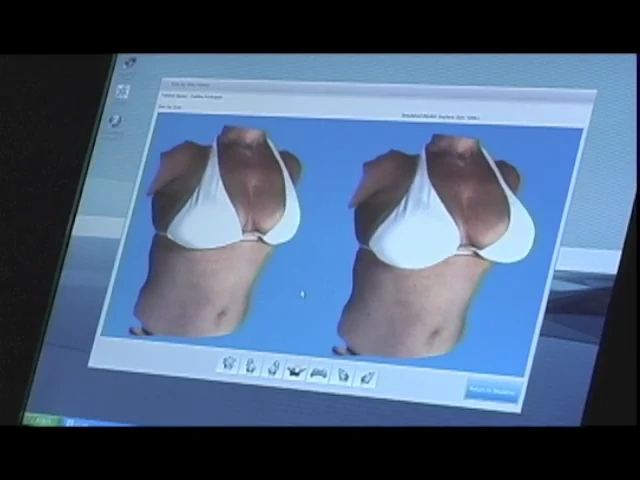 3D Breast Augmentation Simulation