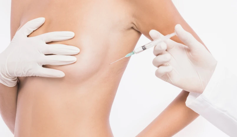 Areola Surgery