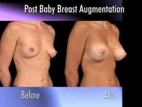 Dr. Nachbar Post-Baby Tune-Up (R)