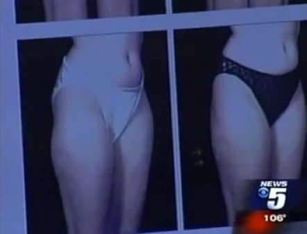 CBS 5 News on Choosing a plastic surgeon