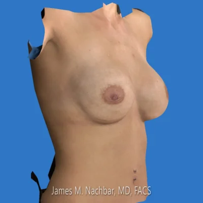 Surgical Simulation