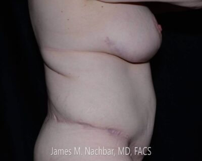 8 Months After