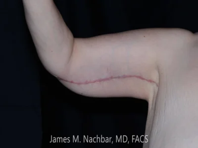 Six Weeks After