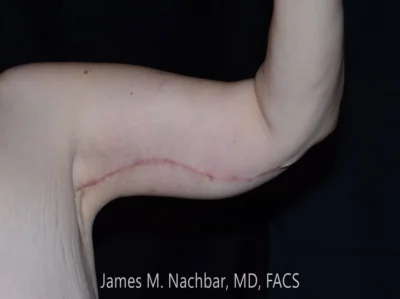 Six Weeks After