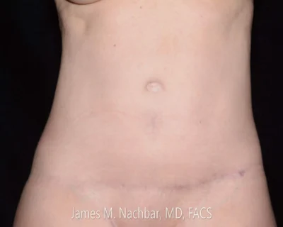 9 Months After