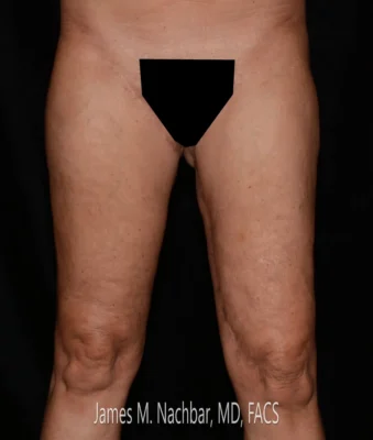 9 Months After