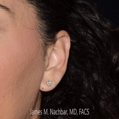 Left Ear with Earring