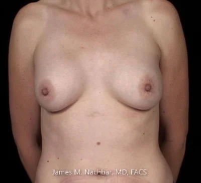 9 Months After