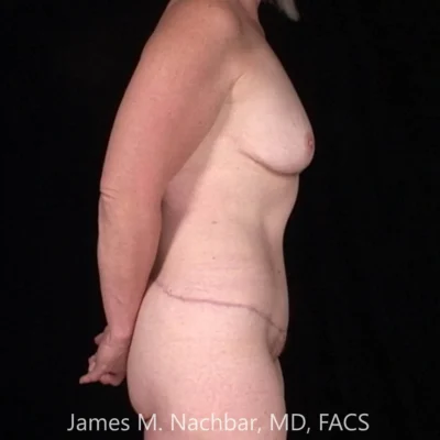 9 Months After