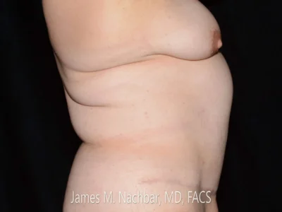 7 Months After