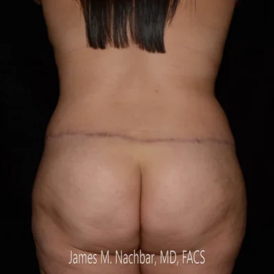 6 Months After