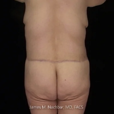 8 Months After