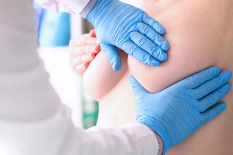 Nipple/Areola Surgery